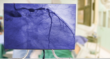 What Is The Purpose Of A Right Heart Catheterization?