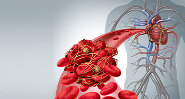 How To Check Heart Blockage At Home?