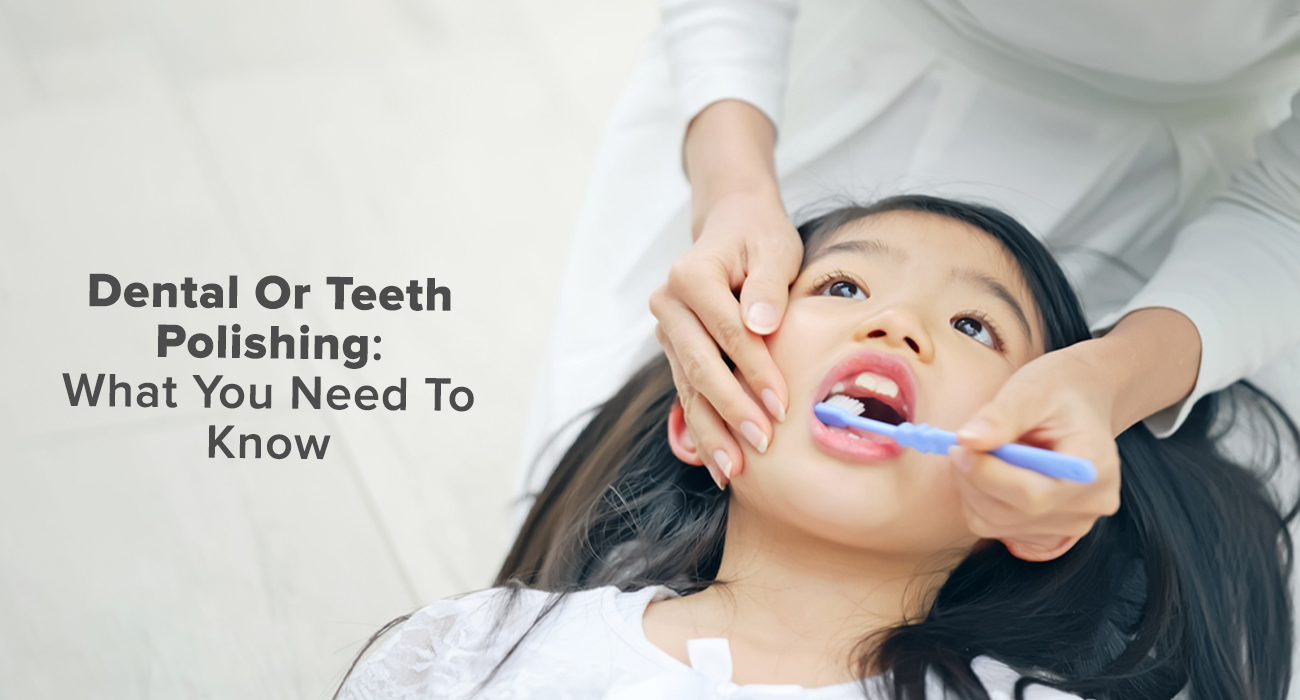 Dental Or Teeth Polishing: What You Need To Know