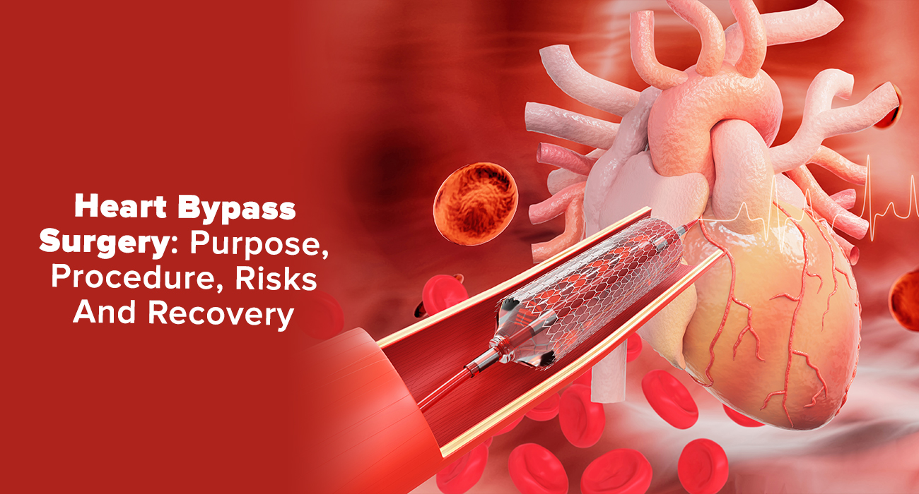 Heart Bypass Surgery: Purpose, Procedure, Risks And Recovery