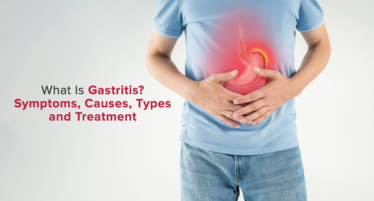 What Is Gastritis? Symptoms, Causes, Types and Treatment