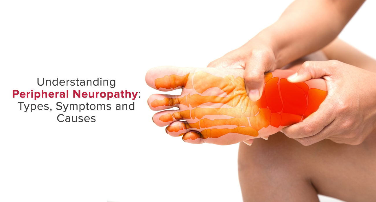 Understanding Peripheral Neuropathy: Types, Symptoms and Causes