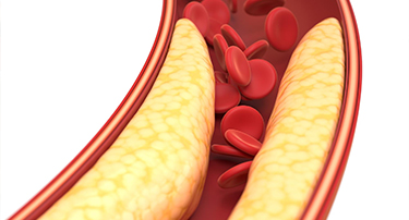 Cholesterol Normal Range: Cholesterol Levels By Age Chart