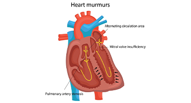 Types Of Heart Murmurs: Causes, Sounds, And What They Mean