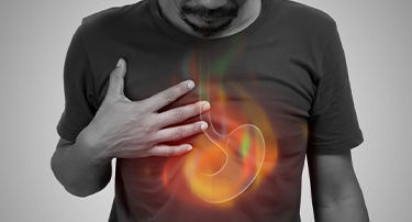 Acid Reflux vs. GERD: How to Manage Chronic Heartburn