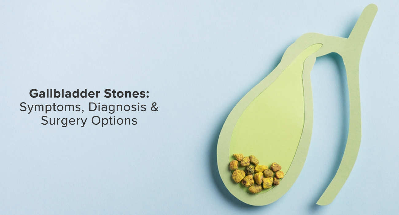 Gallbladder Stones: Symptoms, Diagnosis & Surgery Options